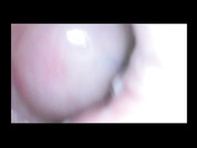 [ManyVids] Milly17 Shy Girl with Endoscope