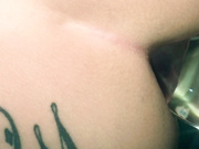 Lilyskye - my first anal prolapse