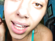Kisses
