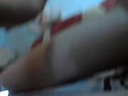 anal prolapse