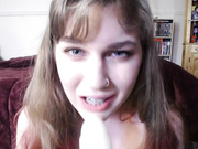 Braces 2