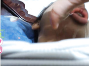 facial